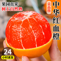誉福园 当季鲜果中华红血橙新鲜橙子现摘孕妇水果10斤红肉橙整箱