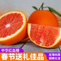 中华红橙子脐橙酸甜细嫩化渣万州云阳秭归橙子新鲜现摘当季新鲜水