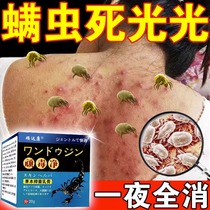 日本进口螨虫药膏人用螨虫叮咬止痒神器脸上过敏除螨祛痘毛孔粗大