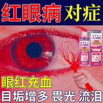 红眼病眼药水止痒消炎杀菌洗眼液日本结膜炎去黄去红血丝抗疲劳CA