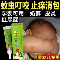 湿疹止痒去跟手廯儿童手脱皮软膏擦手痒干裂真菌感染湿疹除螨软膏
