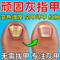 灰指甲一滴净手脚指甲真菌感染药水变厚变硬增厚去坏甲软化剂日本
