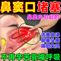 鼻窦炎息肉脱落专根喷剂治疗用洗鼻器盐鼻子堵不通气可搭中成药hh