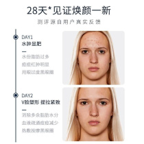 日本HKA脸部按摩器提拉V脸神器面部淡化法令纹瘦脸仪脸部美容仪