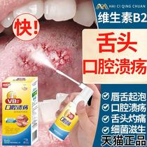 口腔溃疡喷剂专用特效一点灵凝胶蜂胶儿童牙膏棉签棒贴治疗HY
