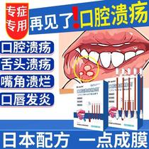 日本口腔溃疡专用棉签棒膏膜贴粉末散特一点滴灵儿童韩国凝胶牙TF