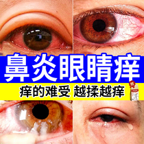 过敏性鼻炎眼睛痒滴眼液眼角痒洗眼液眼药水止痒消杀菌炎CP