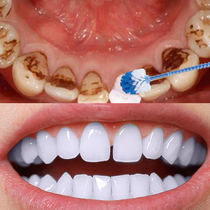云南本草牙斑净牙齿美白速效去黄牙祛除牙菌斑神器烟渍茶渍牙结石