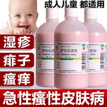 炉甘石洗剂外用止痒婴儿洗剂儿童湿疹荨麻疹痱子药膏去非喷雾DT