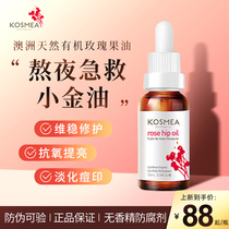 kosmea玫瑰果油淡化痘印保湿抗氧修护肌肤屏障精华油面部护肤精油