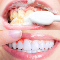 洗牙粉牙齿美白神器去黄除口臭牙渍黄牙结石儿童小苏打牙膏